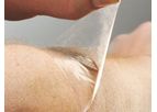 Scapa Soft-Pro - Polyurethane Gel Adhesive