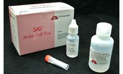 SAS - Model 094100 - Sickle Cell Test Kit