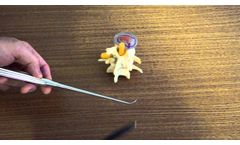Lumbar foraminal Rasp - Video