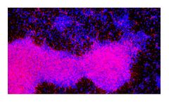 Yashraj - Model FsNPH-25 - iPSCs-derived Neural Progenitor Cells