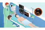 MDoloris Medical Systems presents ANI (Analgesia Nociception Index) technology - Video