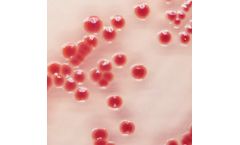Chromagar - Acinetobacter
