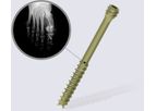 DynafitSystem - Self-Compressive Screw
