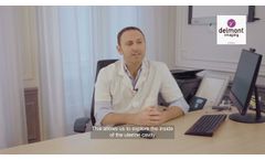 Diagnostic hysteroscopy in office setting with iCare+ - Video