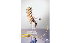 Radimed - Diode Laser and Accessories for Percutaneous Laser Disc Decompression (PLDD)