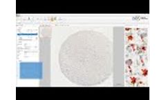Vision Cyto Pap | Automated cervical cancer screening | West Medica - Video