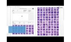 Vision Cyto STD | Digital Microscopy for Diagnostics of Sexually Transmitted Diseases | West Medica - Video