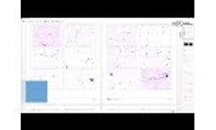 Vision Sperm | Automatic Systems for Sperm Analysis | West Medica - Video