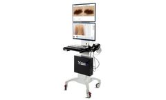 Medici Medical - Model VIDIX 4.0 - Revolutionary Digital Videodermatoscope
