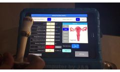 Fisiocomputer BFB4 - Double Channel Electromyographic Biofeedback - Part 3 - Anal and Vaginal Probe - Video