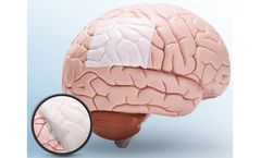 Medprin NeoDura - Novel Dural Patch