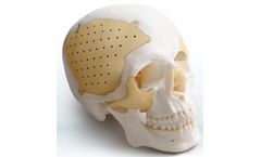 Medprin Recranio - Cranio-Maxillofacial Repair System