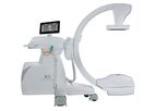 Eurocolumbus - Model vers alien 2121 cardio - C-arms with Flat Panel Detectors