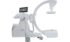 Eurocolumbus - Model vers alien 2121 75 - C-arms with Flat Panel Detectors