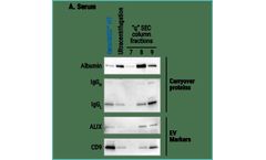 Model SmartSEC - HT EV Isolation System for Serum & Plasma