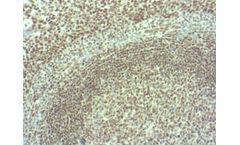 Model ATRX (D-5) - Primary Antibodies