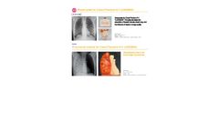 Kyoto Kagaku - SAMPLE_Pneumonia module for Chest Phantom N-1 LUNGMAN Datasheet