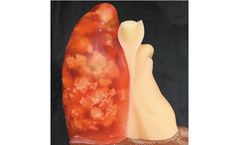 Kyoto Kagaku - SAMPLE_Pneumonia module for Chest Phantom N-1 LUNGMAN
