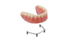 Dental implants Prothetics
