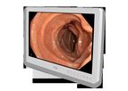 Model FS-E2101D 21.5 inch HD - Medical Grade Monitor