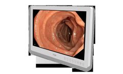 Model FS-E2101D 21.5 inch HD - Medical Grade Monitor
