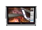 Model FS-E2101DT 21.5 inch - Touch Medical Grade Monitor