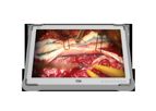 Model FM-B2702D, FM-B2702DG 27 inch - 4K UHD Medical Grade Monitor