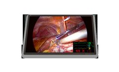 Model FM-C5501DV 55 inch - 4K UHD Medical Grade Monitor