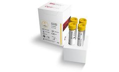 DiaMex - Optitrol Serology