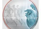Model ECG Algorithms - Automated Analysis of Diagnostic Ecg Data