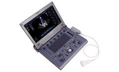 Lanmage - Model C6 - Portable Color Doppler Ultrasound System