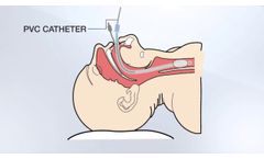 Siliconised Endotracheal Tube ??? Cuffed & Plain - Video