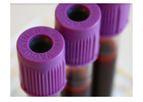 AcouSort - Automated Sample Preparation Modules