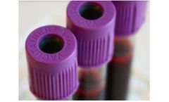 AcouSort - Automated Sample Preparation Modules