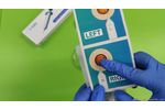 Preloaded Capsular Tension Ring - Video