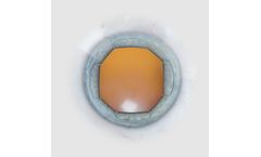 Model X1 - Iris Speculum