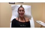 Patient Testimony after 4D Under Eye Lift as part of a non-surgical facelift (Liquid Facelift) - Video
