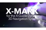 Introducing X-MARK Virtual Registration for X-Guide Dynamic 3D Navigated Implant Surgery - Video