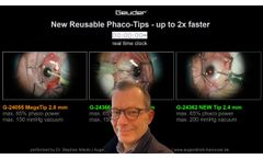 New Reusable Phaco Tips - up to 2x faster - Video