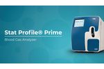 StatProfile Prime Blood Gas Analyzer from Nova Biomedical | TECOM Analytical Systems - Video