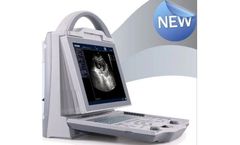 Diagnovision - Model KX-5600 Vet - Ultrasound Machine Vet