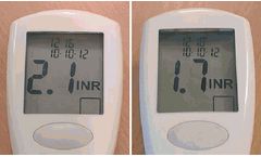 Bio-AMD - Blood Coagulation Monitor