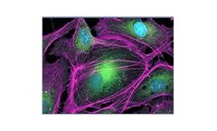 Protein Expression Services