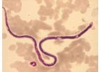 Milenia - Model Acanthocheilonema viteae - IgG ELISA Kit