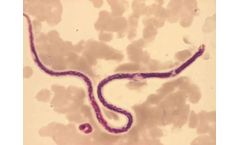 Milenia - Model Acanthocheilonema viteae - IgG ELISA Kit