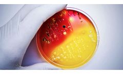 AEGIS Microbe Shield - Revolutionary Bonded Antimicrobial Technology for Polymers and Textiles