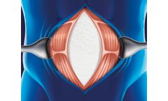 CELLIS - Collagen Matrix for Soft Tissue Repair