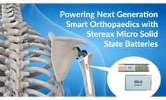 Powering Smart Orthopaedic Implants - Video