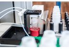 Acaros Volumetric - Automatic Sample Preparation Solution