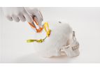 Model Cranial LOOP - Cranial Fixation Devices
